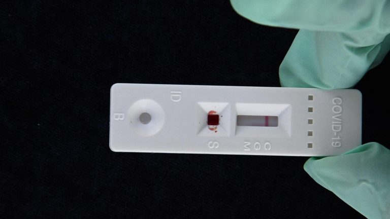 Covid, meno diffusione al Sud grazie alla qualità di una molecola